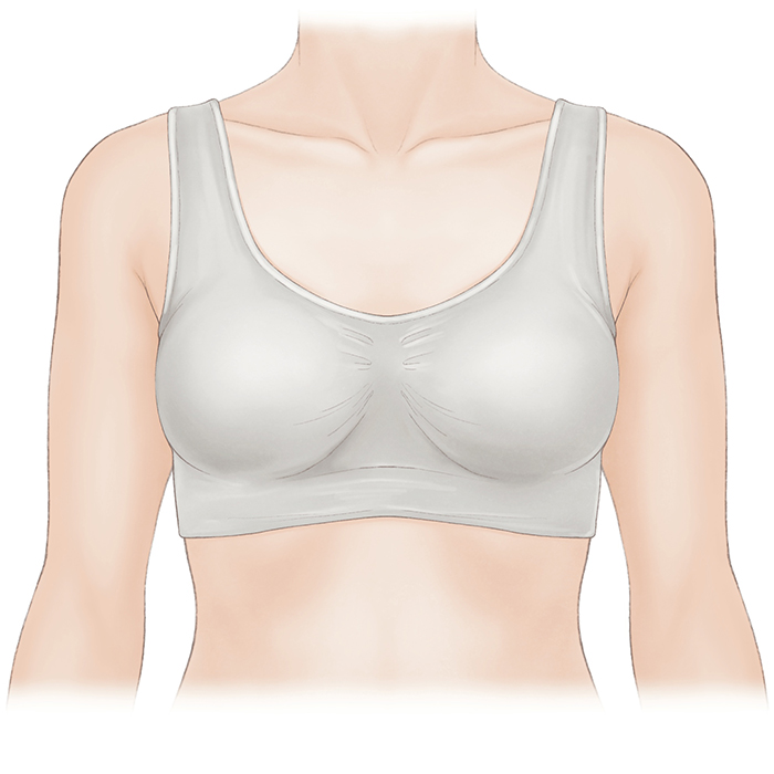 乳房オンコプラスティック・サージャリー 2 症例から学ぶ手術