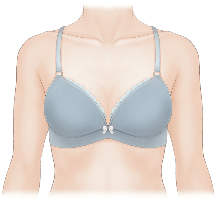 乳房オンコプラスティック・サージャリー2 症例から学ぶ手術手技 乳房オンコプラスティック・サージャリー 2 症例から学ぶ手術